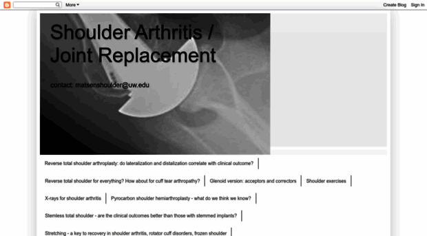 shoulderarthritis.blogspot.com