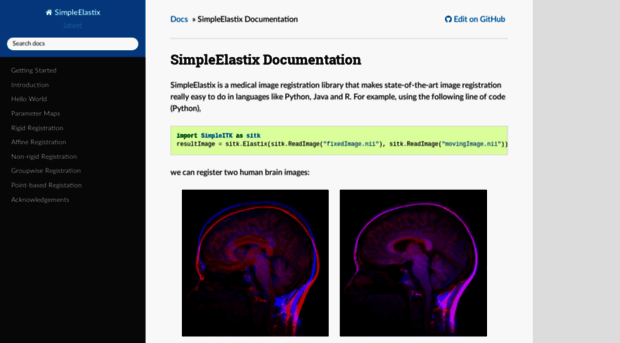 simpleelastix.readthedocs.io