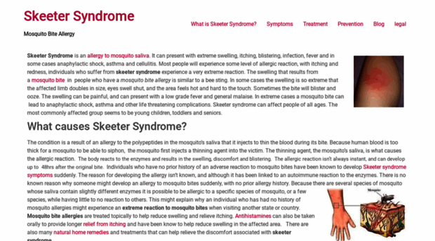 skeetersyndrome.net
