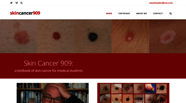 skincancer909.com