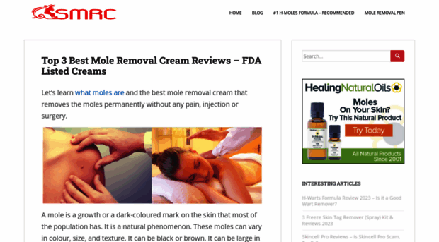 skinmoleremovalcream.com