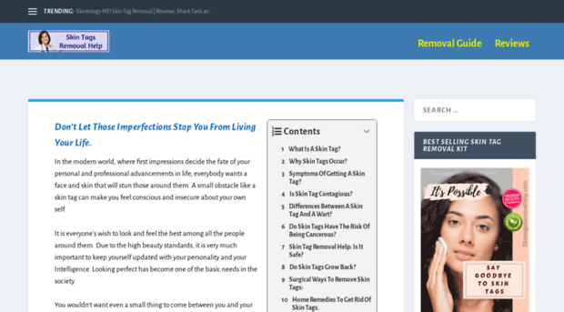 skintagsremovalhelp.com