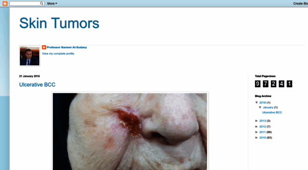 skintumors.blogspot.com