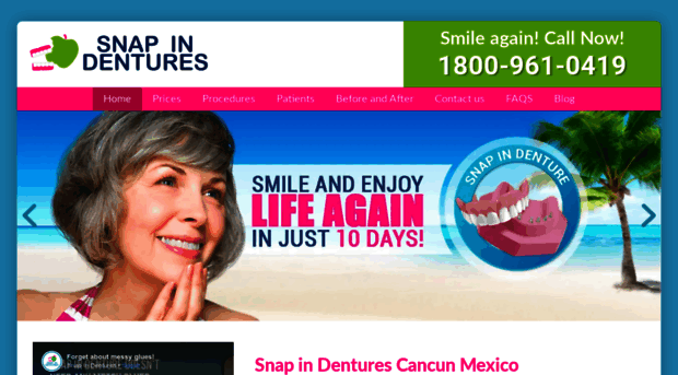 snapindentures.dental