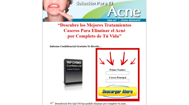 solucionparaelacne.org