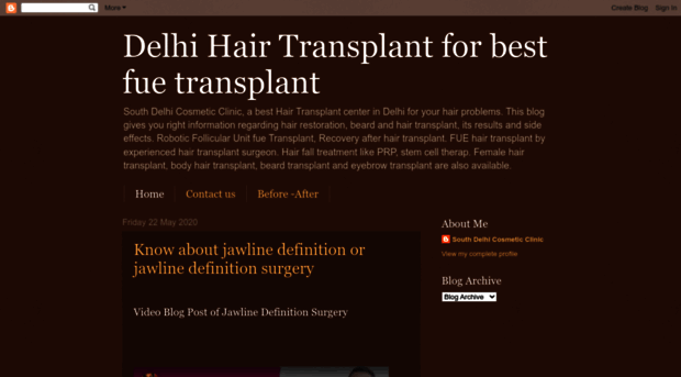 southdelhihairtransplant.blogspot.com