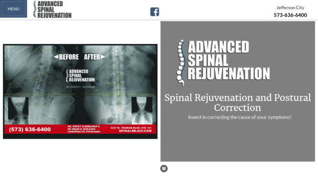 spinalrejuv.com