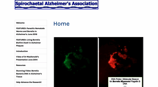 spirodementia.wordpress.com