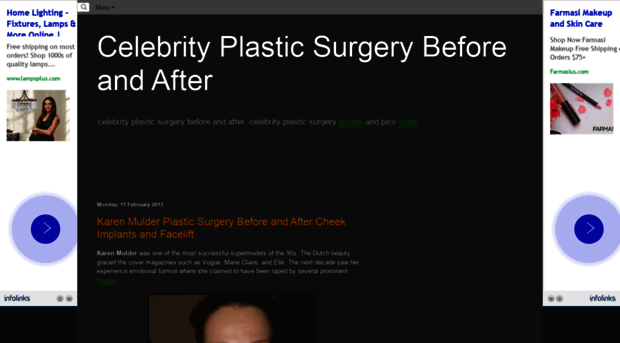 splasticsurgery.blogspot.com