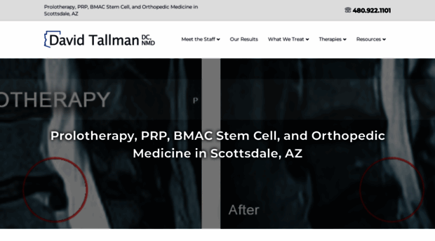 spondylolisthesis.com