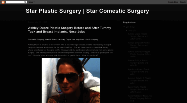 starplasticsurgerybeforeafter.blogspot.com