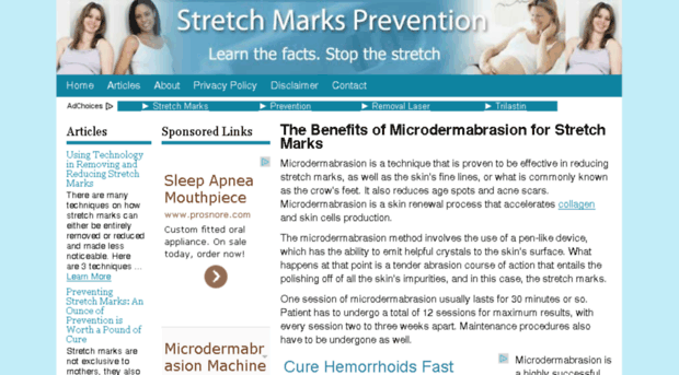 stretch-marks-prevention.com