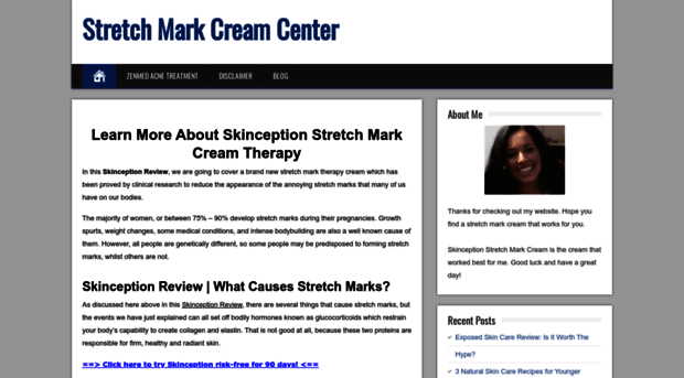 stretchmarkcreamcenter.com
