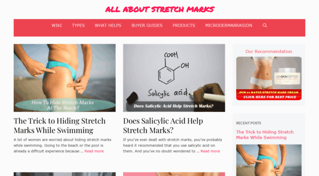 stretchmarkremovalinfo.com