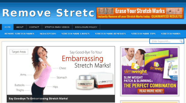 stretchmarksmagic.com