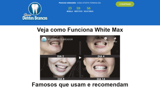 superdentesbrancos.com