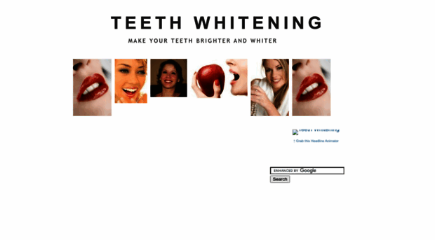 system-teeth-whitening.blogspot.com