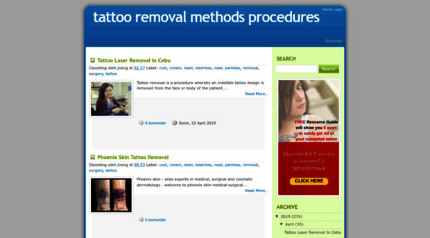 tattooremovalmethodsprocedures.blogspot.com