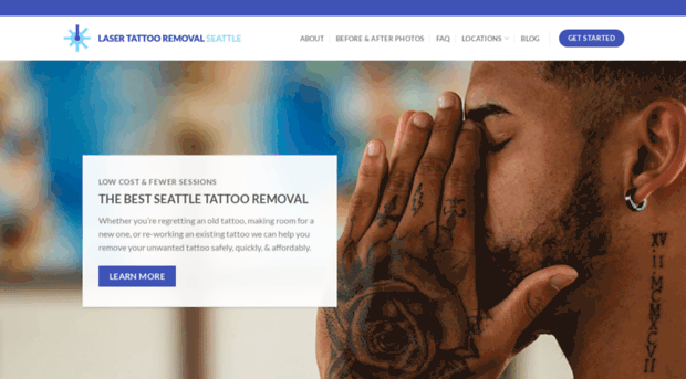 tattooremovalseattle.com