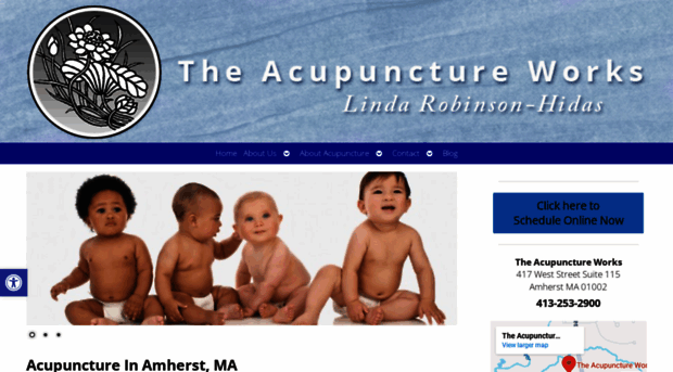 theacupunctureworks.net