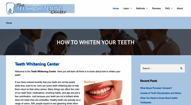 theteethwhiteningcenter.com