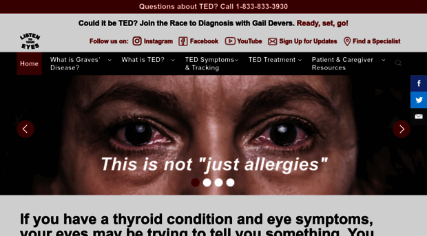 thyroideyes.com