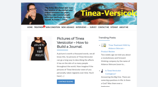 tinea-versicolor.net