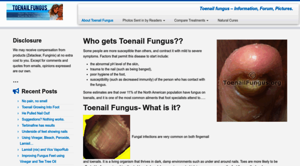 toenailfungus.org