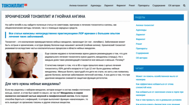 tonsillit.ru