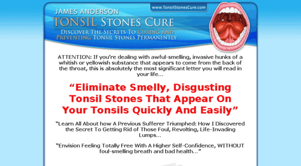 tonsilstonescure.tonsilstonescure.com