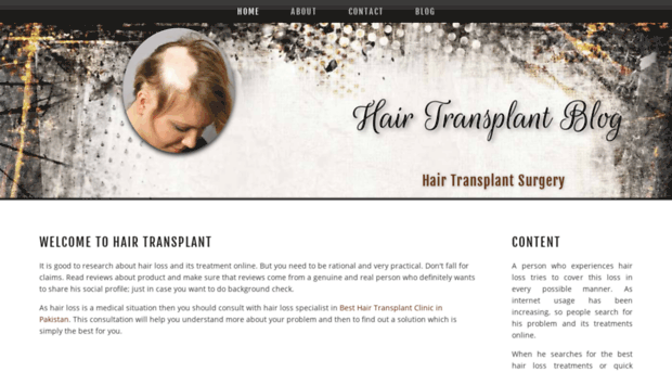 transplanthair.jigsy.com