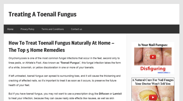 treatingatoenailfungus.com