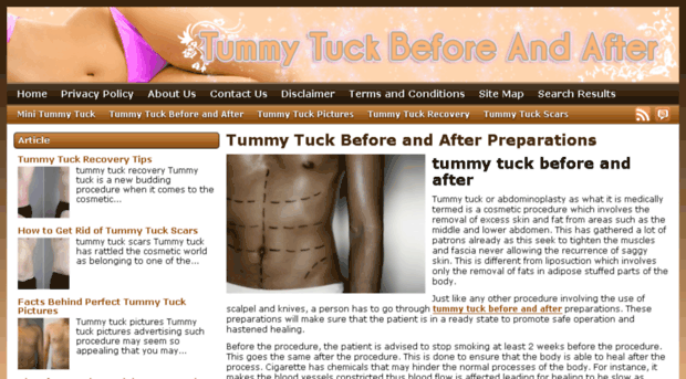 tummytuckreview.net