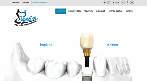 turkiye-implant.com