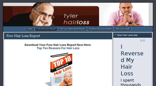 tylerhairloss.com