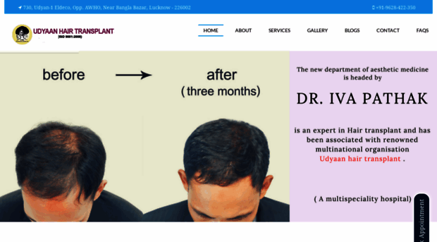 udyaanhairtransplant.com