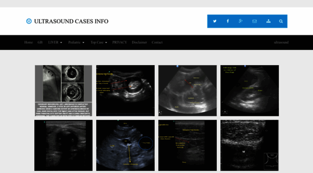 ultrasound-cases.blogspot.com