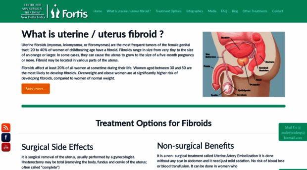 uterusfibroidtreatment.com