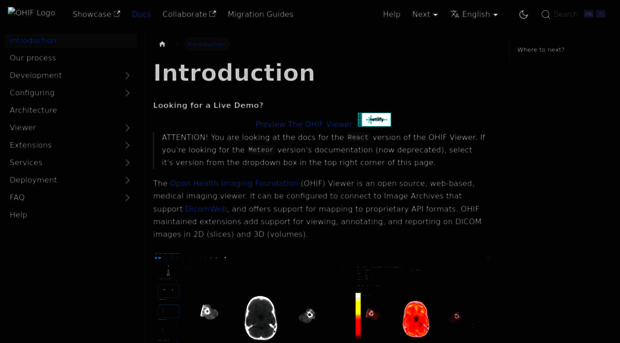 v2.docs.ohif.org