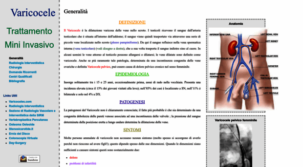 varicocele.it