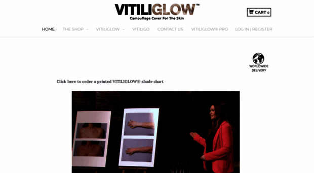 vitiliglow.co.uk