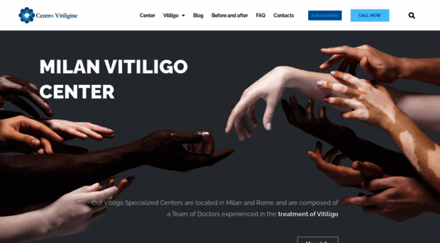 vitiligo.com