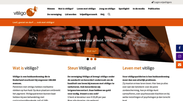 vitiligo.nl