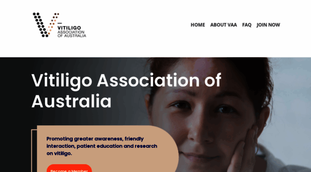 vitiligo.org.au