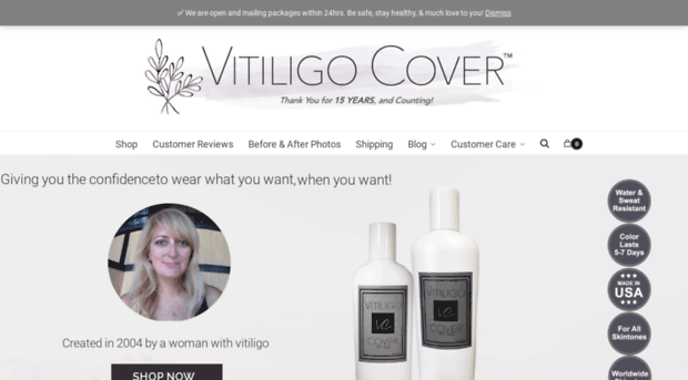 vitiligocover.com