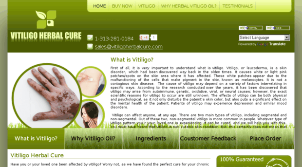 vitiligoherbalcure.com