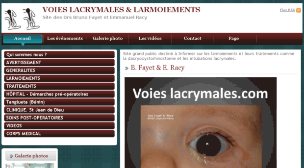 voies-lacrymales.com