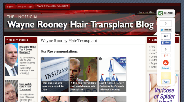waynerooneyhairtransplant.com