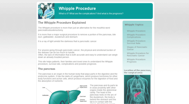 whipple-procedure.org