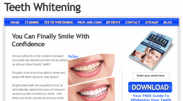 whiteteeth101.com